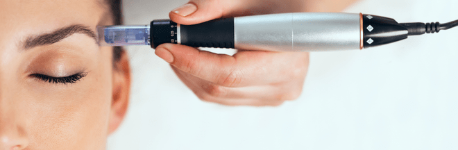 dermapen (2)