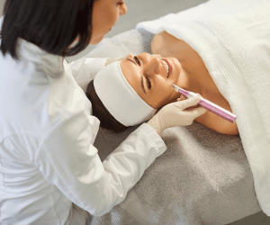dermapen02