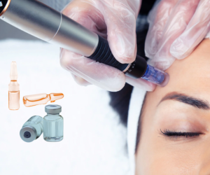 dermapen03